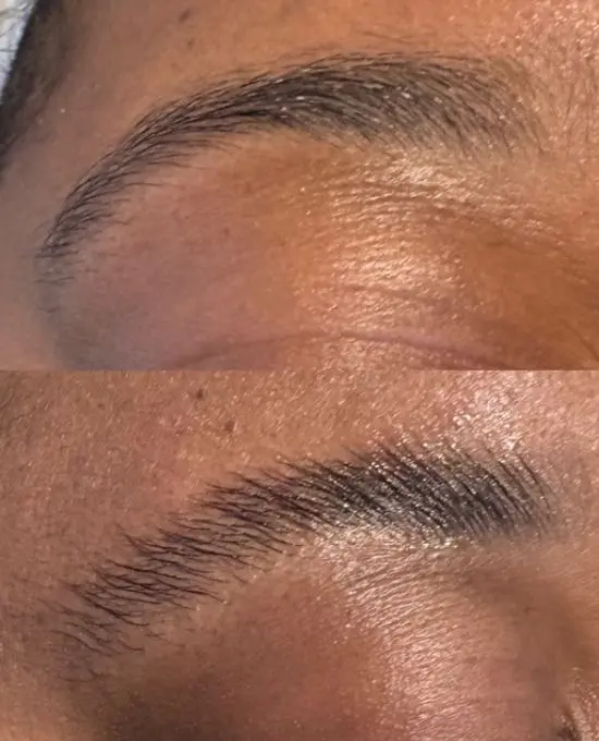 Before and After Brow Shaping