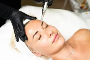 Microneedling In Folsom & Stockton, CA
