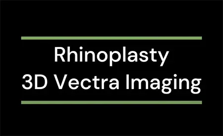 3D imaging discussion for rhinoplasty surgery