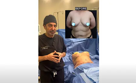 Dr. Mabourakh describing mommy makeover surbgery
