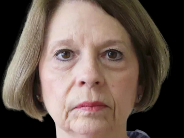 Eyelid Surgery Patient 10 Before 1