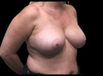 After Image
