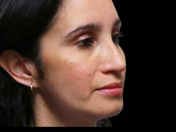 Rhinoplasty Patient 13 After 2