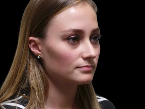 Rhinoplasty Patient 19 Before 2