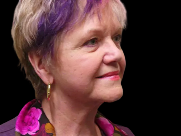 FaceLift Patient 06 After 2