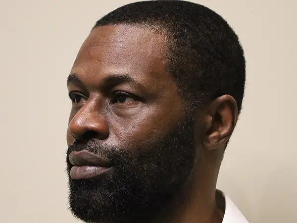 Rhinoplasty Patient 48 After 2