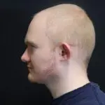 Before Image