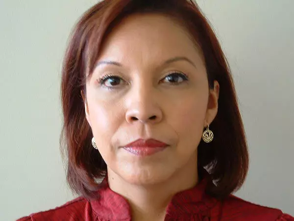 Brow Lift Patient 03 After 1