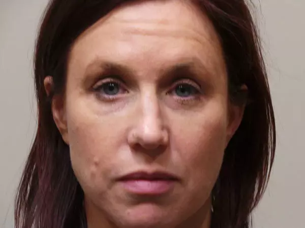 Eyelid Surgery Patient 13 After 1