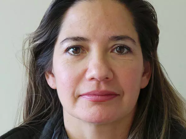 Eyelid Surgery Patient 16 After 1