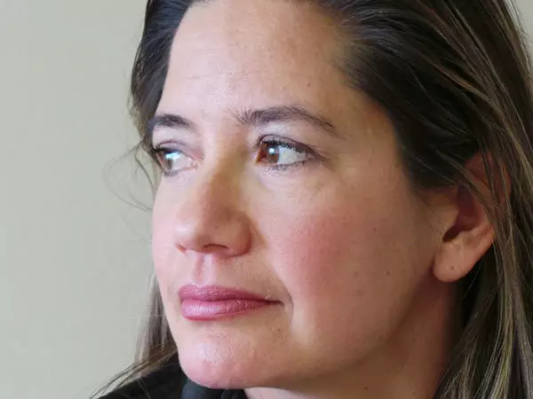 Eyelid Surgery Patient 16 After 2