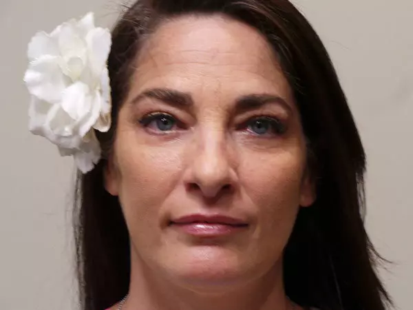 Eyelid Surgery Patient 11 After 1