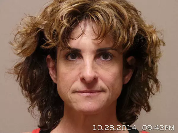 Facelift Patient 09 Before 1