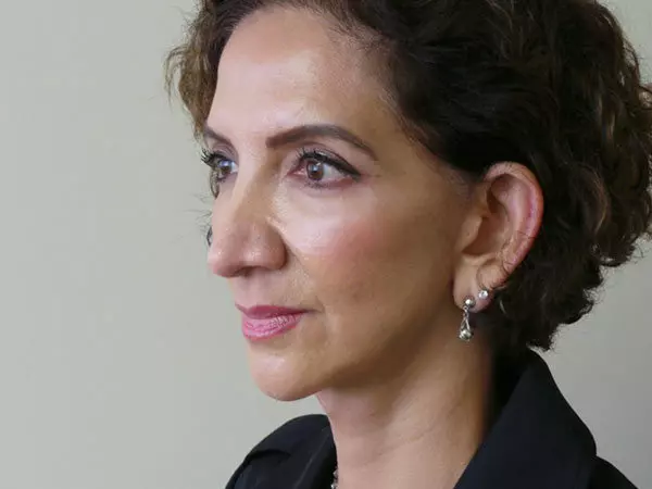 FaceLift Patient 05 Before 2