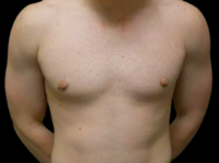 After Image