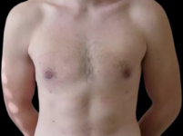 After Image