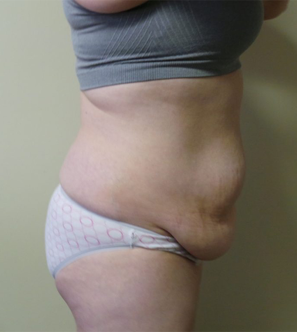 before-2
