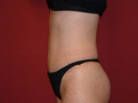 After Image