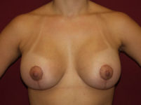 After Image