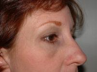 After Image