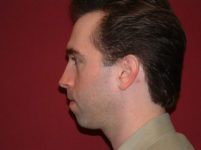 Before Image