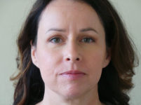 After Image