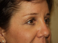 After Image