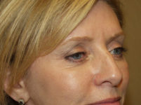 After Image
