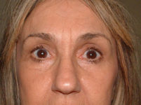 After Image
