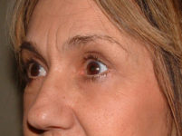 After Image