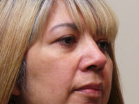 After Image