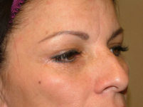 After Image