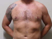 After Image
