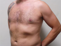 After Image