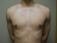 After Image