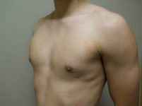 After Image