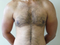 After Image