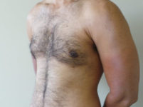After Image