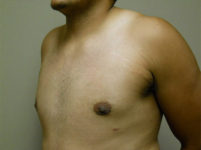 After Image