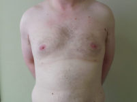 After Image