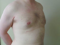 After Image