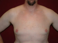 After Image
