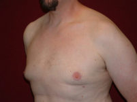 After Image