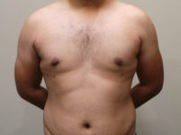 After Image