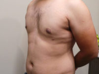 After Image