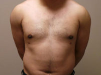 After Image
