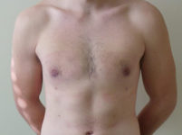 After Image
