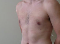 After Image