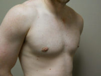 After Image