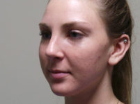 After Image